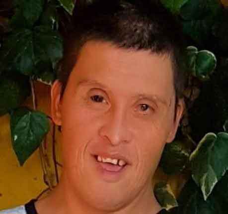Foto del rostro de un hombre con síndrome de Down que mira a la cámara.